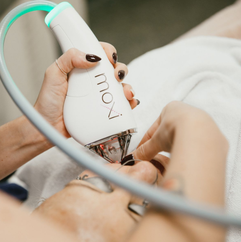 8 Things to Remember Before Opting for Moxi Laser